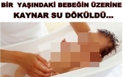 1 Yaşındaki Bebeğin üzerine Kaynar Su Döküldü