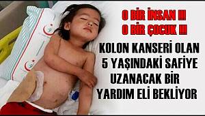 AKSARAY'DA KANSER HASTASI ÇOCUĞUN DRAMI