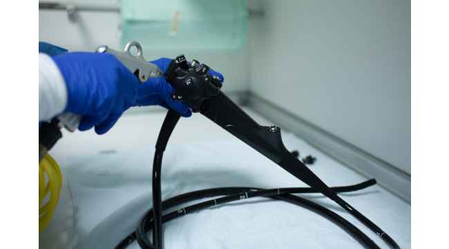 Endoskopi Fiyatları 