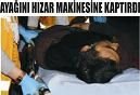 Ayağını Hızar Makinesine Kaptırdı...