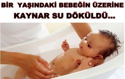 Bir Yaşındaki çocuğun üzerine Kaynar Su Döküldü...