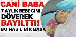 Cani Baba 7 Aylık Bebeği Döverek Komalık Etti,,,
