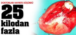 Karından çıkanlar Doktorları Hayrete Düşürdü